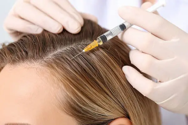 Hair loss management img 3