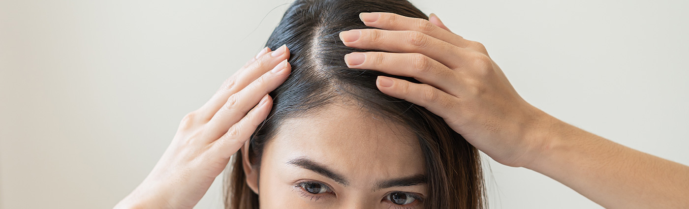 Total Hair Restoration woman holding hands up to head