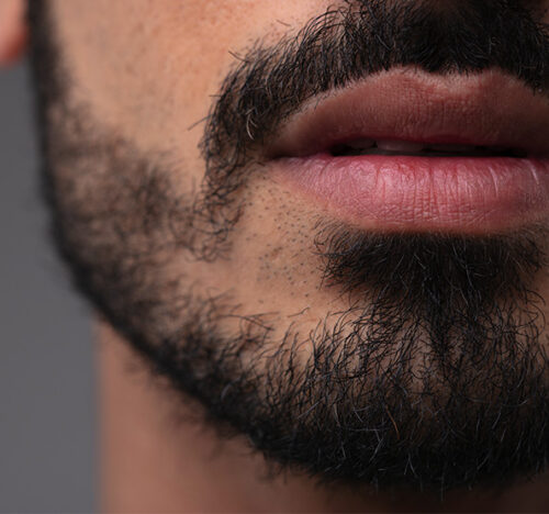 Total Hair Restoration close up of a beard