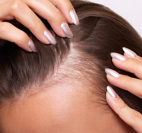 Total Hair Restoration woman parting hair