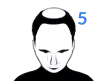 Level 5
